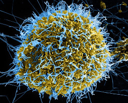 Желто-голубой вирус Эбола